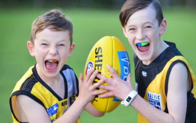 Custom-Fit Mouthguards – Why you should wear one after Orthodontic treatment